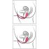 SMILE - Huevo vibrador inalámbrico y con radio (rosa)