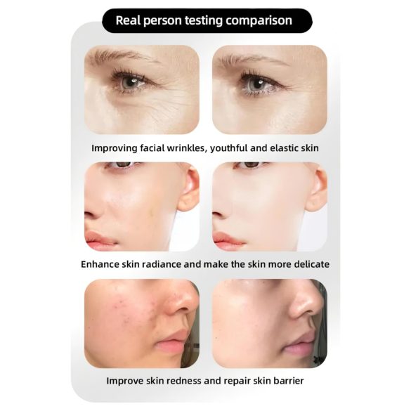 Máscara LED Rejuvenecedora Photon